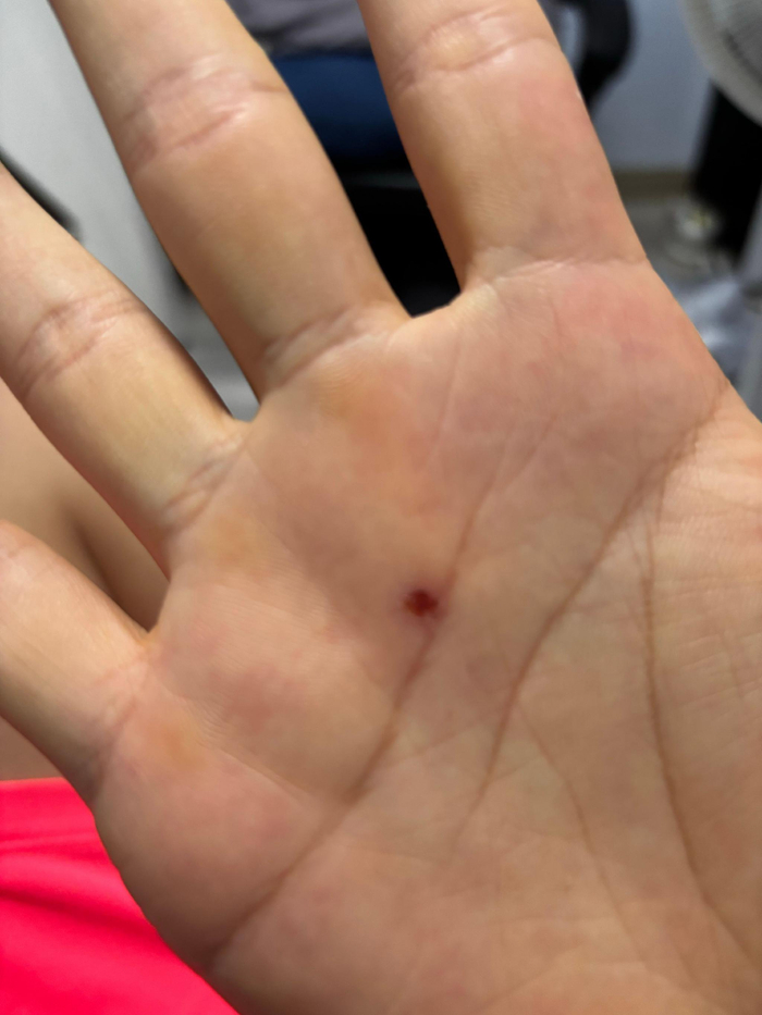 leyu公司-掌心戳伤影响握拳拿物|nba|手掌心|伤口_新浪体育_新浪新闻
